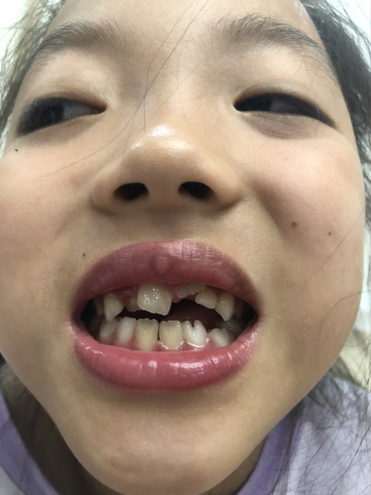 莊最新牙齒技術(shù)揭秘，牙齒美容新選擇